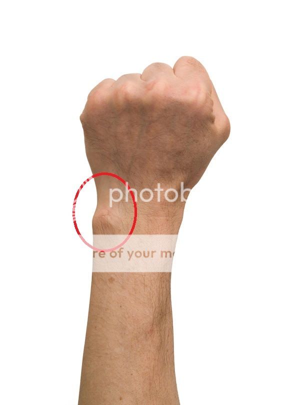 pain in wrist Sherdog Forums UFC, MMA & Boxing Discussion